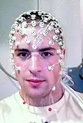 An EEG recording at Dalhousie University