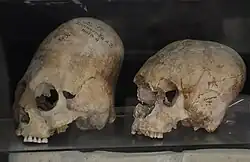 Elongated skulls from Afrasiab, Samarkand, Sogdia, 600–800 CE