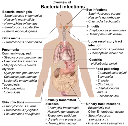 chart showing bacterial infections upon various parts of human body