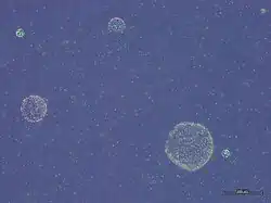 Phaeocystis globosa colonies.