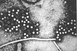 TEM micrograph of Hepatitis E virus virions
