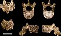 Views of a tenth thoracic vertebra