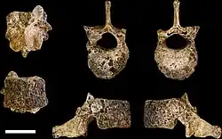 Views of an eleventh thoracic vertebra