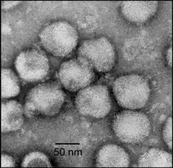 Electron micrograph of negatively stained NDiV virions