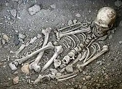 A disarticulatedtle=Grave shortcomings: the evidence for Neandertal burial