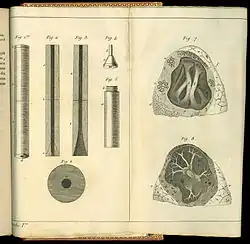 De l'auscultation médiate .... Drawings of the stethoscope and lungs.