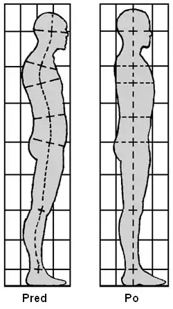 Two diagrams of a human figure in profile. The one on the left has a hunched posture, whereas the one on the right has an upright posture.