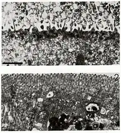 The micrograph at the top shows a damaged cell with a destroyed surface. The micrograph at the bottom shows a healthy cell with its surface intact.