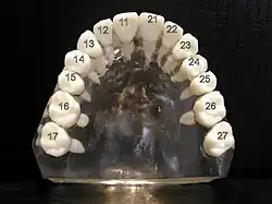 ISO notation upper jaw
